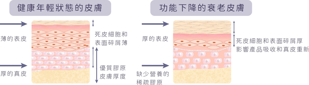 去除老化角質的重要性